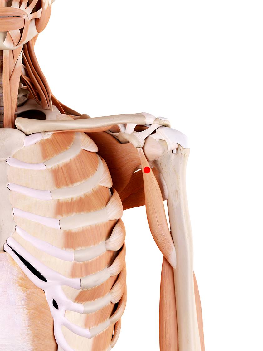 Triggerpunkte im Hakenarmmuskel können dazu führen, dass der Arm nicht mehr auf den Rücken gelegt werden kann. Außerdem wird der von einem Nerv durchzogen der durch eine Verhärtung gedrückt wird. Dies führt zu Schmerzen und neurologischen Ausfallerscheinungen am Ellenbogen, Trizeps sowie Unterarm.
