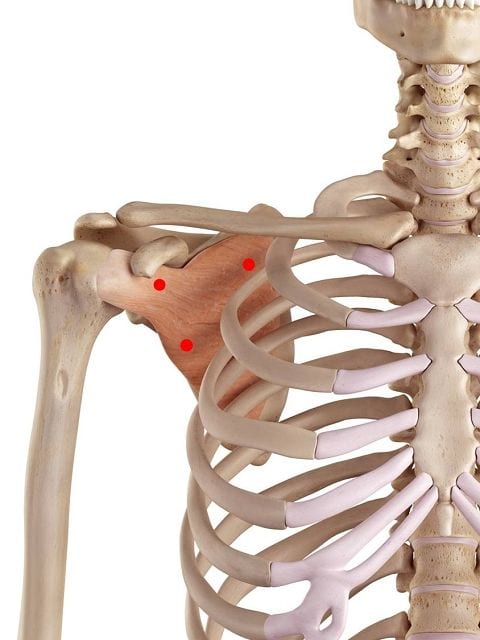 Triggerpunkte im Unterschulterblattmuskel verursachen Schulterschmerzen bei Bewegung und in Ruhe. Ebenfalls können zu neurologischen Ausfällen im Arm führen. Außerdem führen sie zu Bewegungseinschränkungen in der Schulter und Arm.