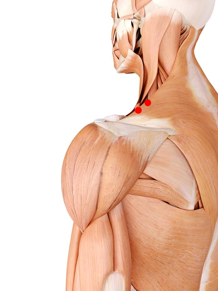 Der obere Trapezmuskel ist Teil des Trapezmuskels und ist zuständig für die Kopfdrehung sowie das heben der Schultern. Triggerpunkten vorhandene Triggerpunkte können Nacken- und Spannungskopfschmerzen auslösen.