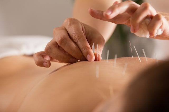 Akupunktur eine aus der TCM (traditionellen chinesischen Medizin) stammende Therapie. Mittels klinischer Studien wurde bereits bewiesen, dass eine Behandlungen bei schmerzenden Arthrosen, chronischen Rückenschmerzen und der Vorbeugung von Migräne wirksam sind.